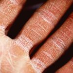 Can dehydration make you dizzy?